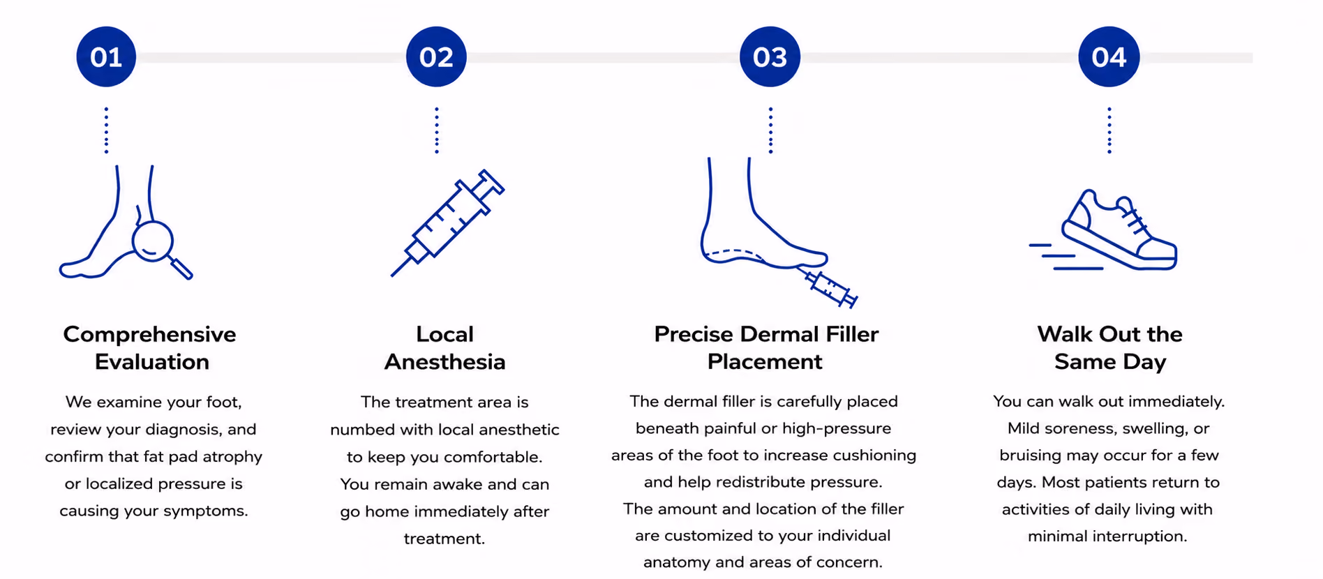 The four steps of dermal filler treatment for the foot: evaluation, local anesthesia, filler placement, and walking out the same day
