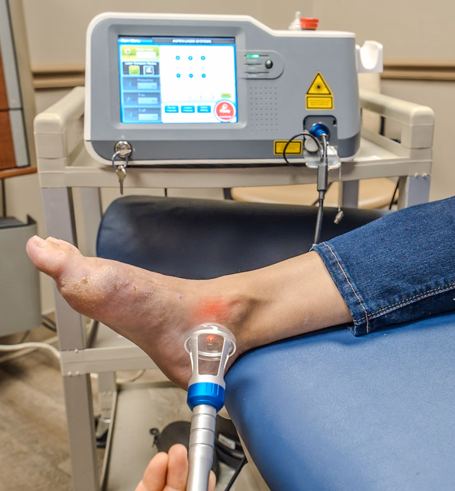 Laser therapy applied to a patient's foot for heel and foot pain