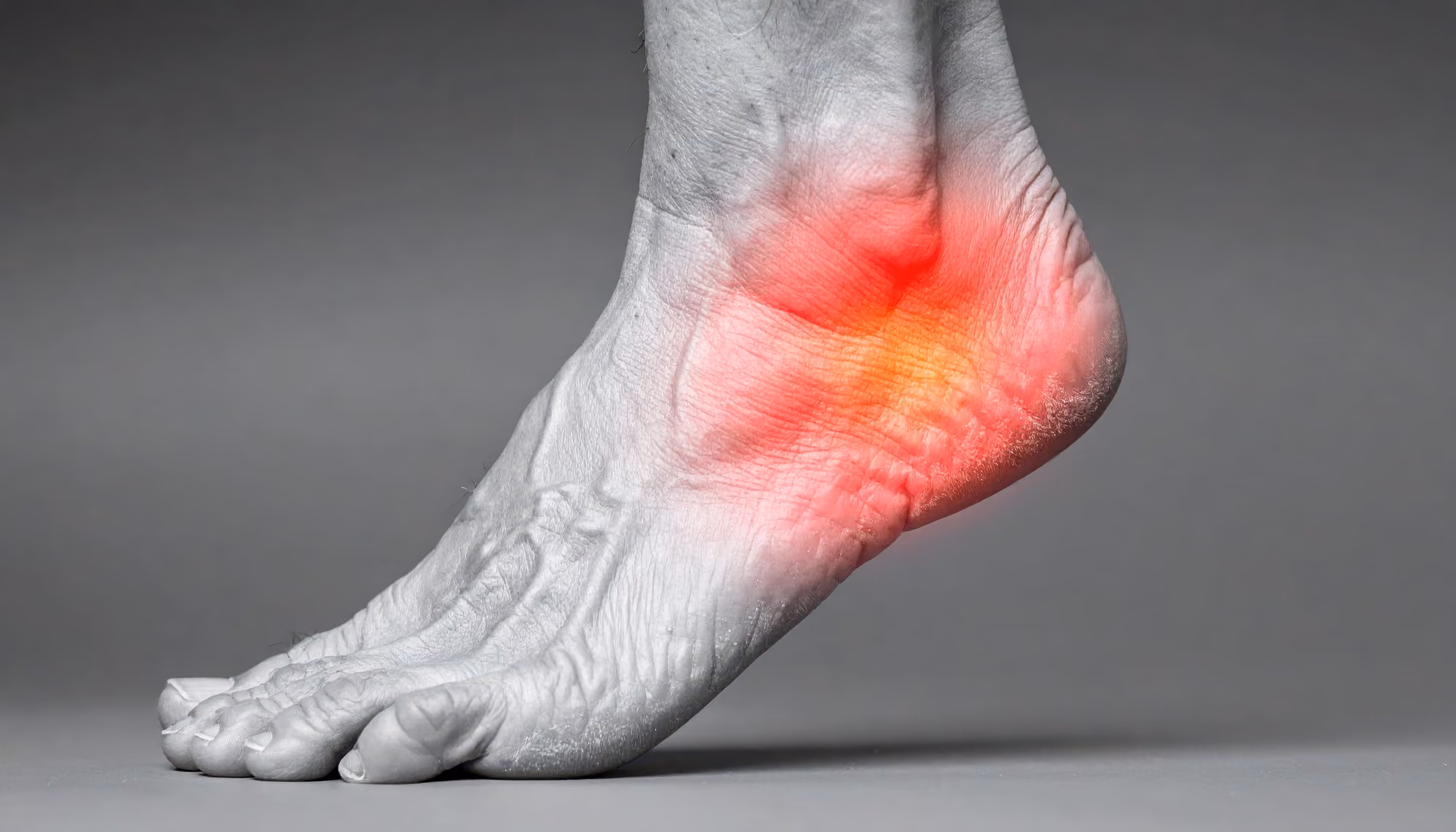 Peroneal tendinitis causing pain along the outer ankle