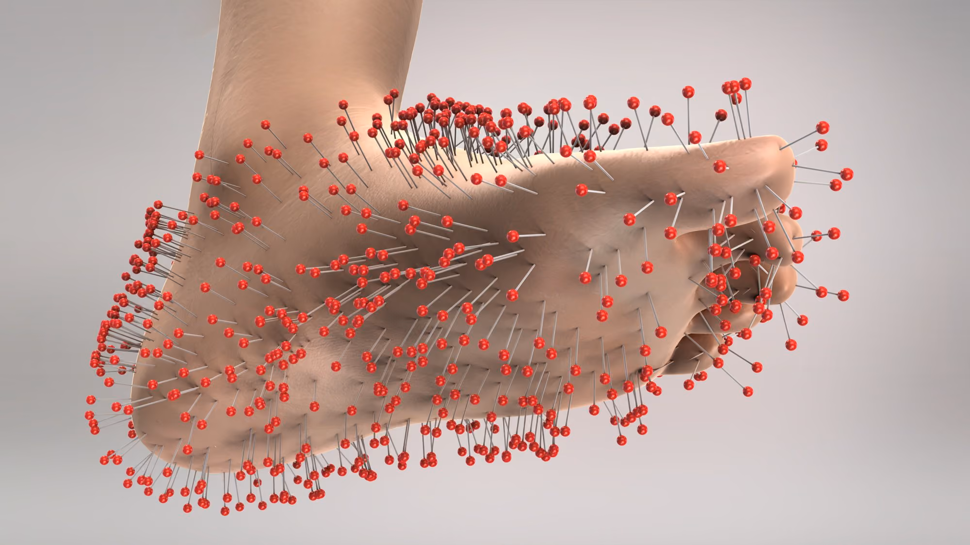 Illustration of nerve pain and tingling through the foot in peripheral neuropathy