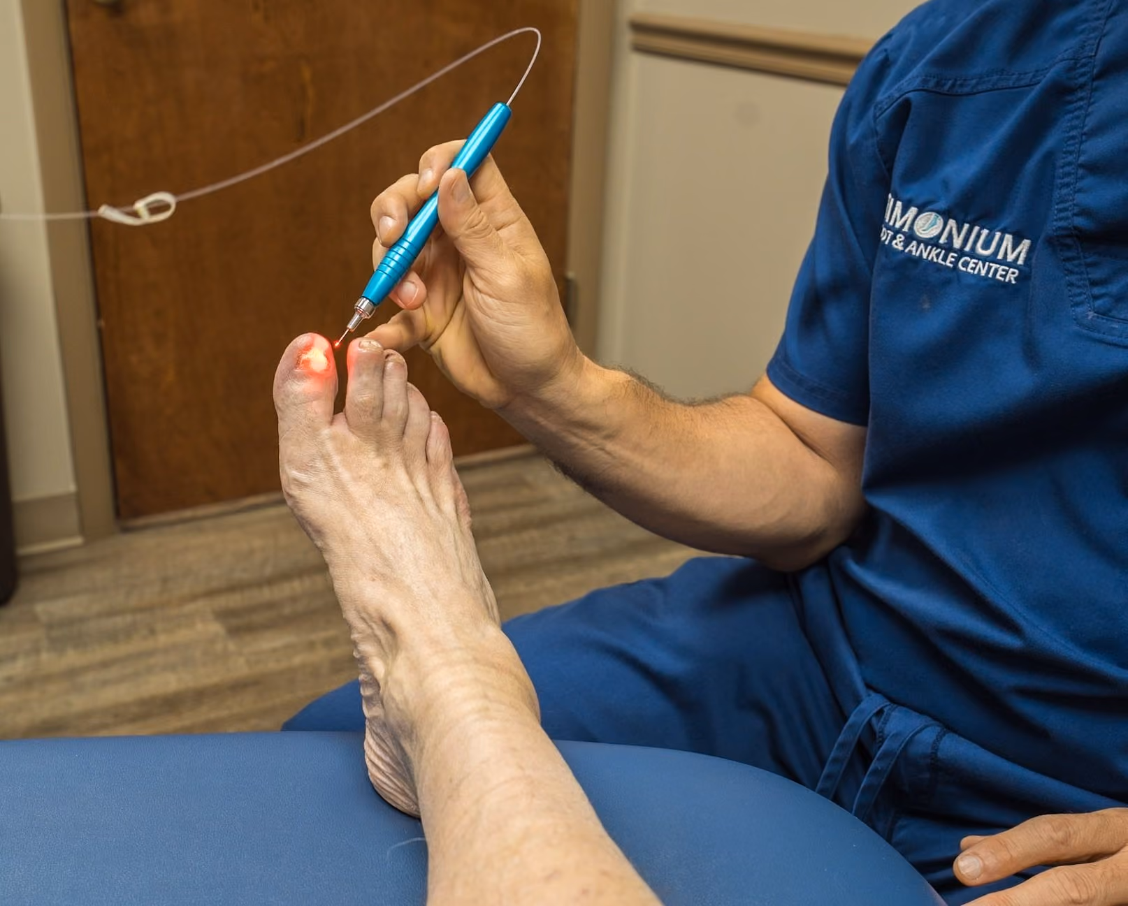 Laser treatment for toenail fungus