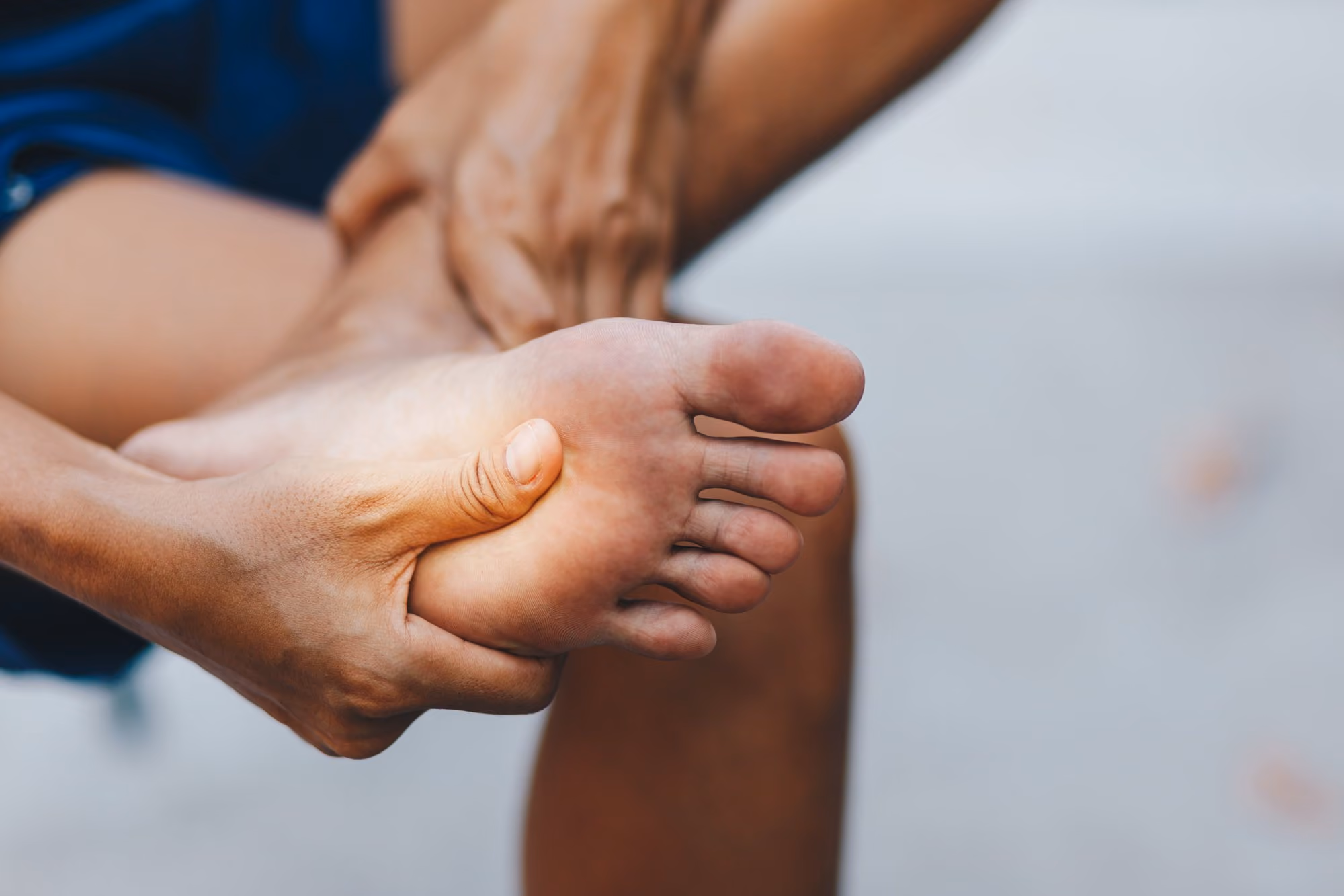Radiesse dermal filler treatment to cushion the ball of the foot