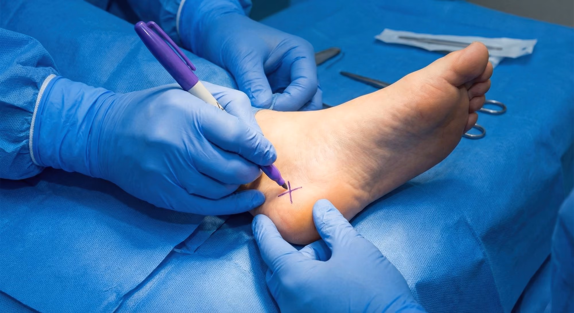 In-office foot procedure at Timonium Foot and Ankle Center