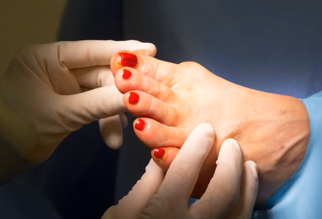 Bunion surgery on the big toe joint