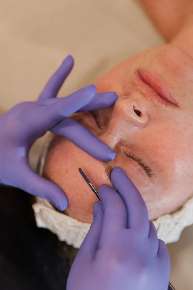 Esthetician performing a gentle dermaplaning treatment