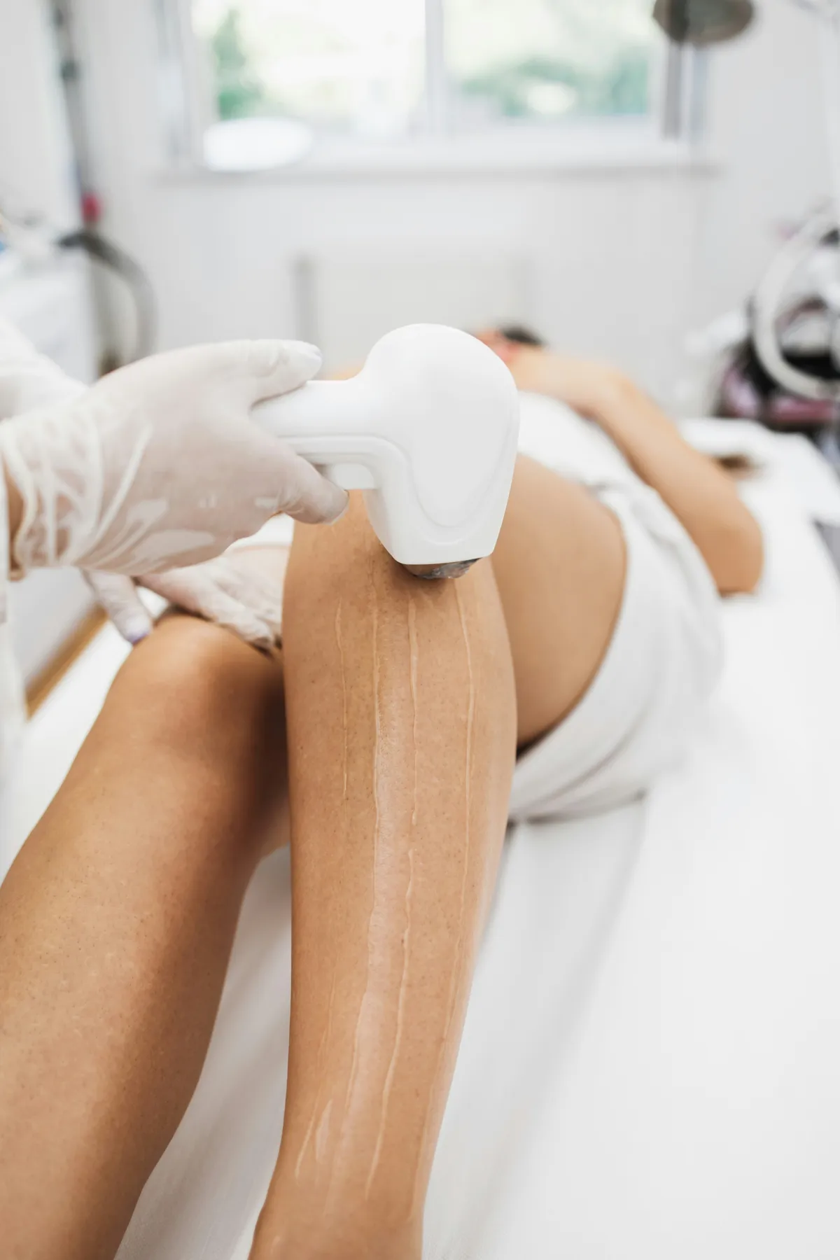 Provider gliding a laser hair removal handpiece along a client's leg