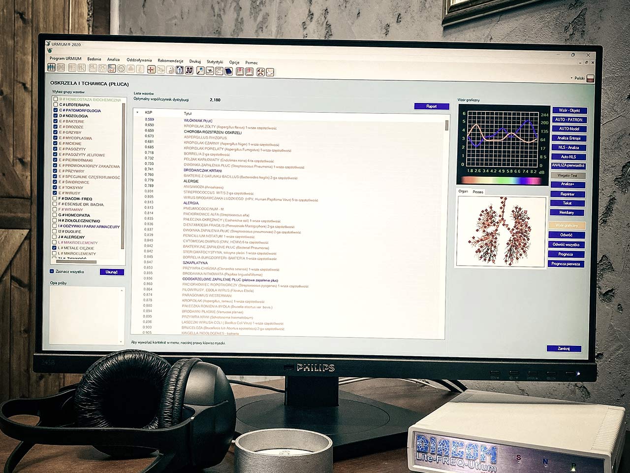 Naszą diagnostykę biorezansową opieramy na urządzeniu DIACOM certyfikowanym światowym liderze urządzeń diagnostycznych w biomedycynie.