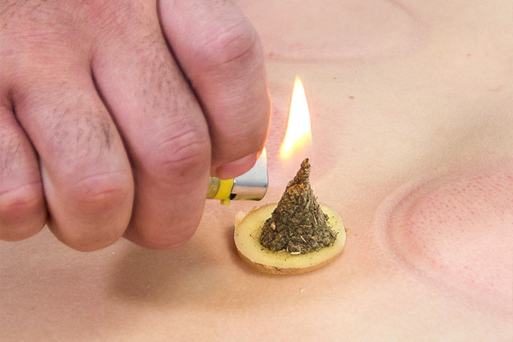 Moksoterapia w HOLISTIC MED™