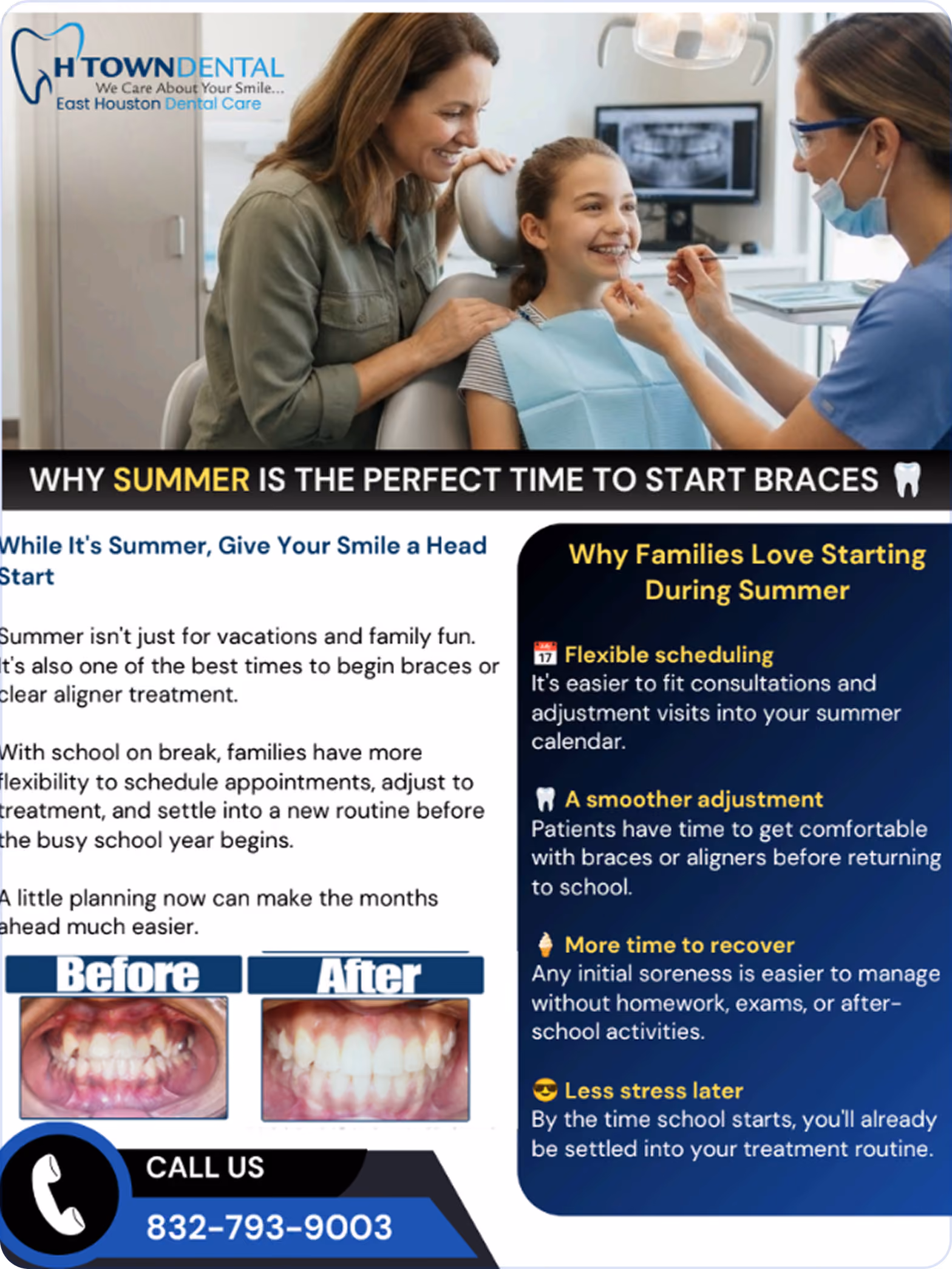 Promotional graphic for H Town Dental highlighting professional teeth whitening with safe, effective results and a smiling woman making a heart shape with her hands around her mouth. The graphic urges viewers to call (832) 793-9003 to learn more or schedule an appointment.