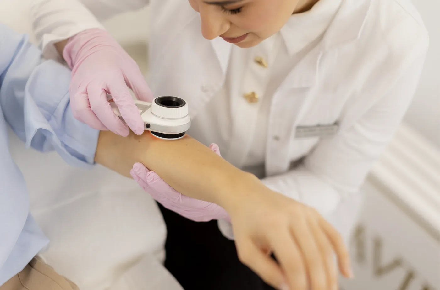 Doctor checking a patient's arm with a dermatoscope