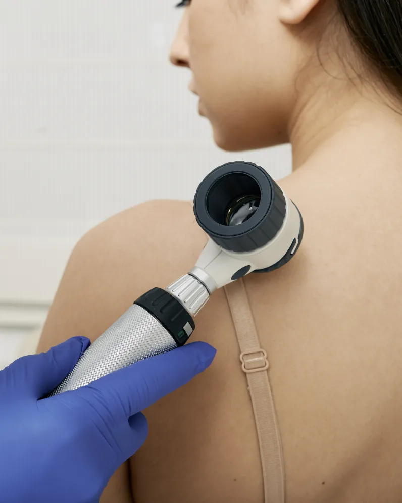 Dermatoscope examination of the shoulder during a full body skin check