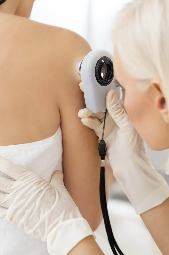 Doctor looking through a dermatoscope during a skin examination