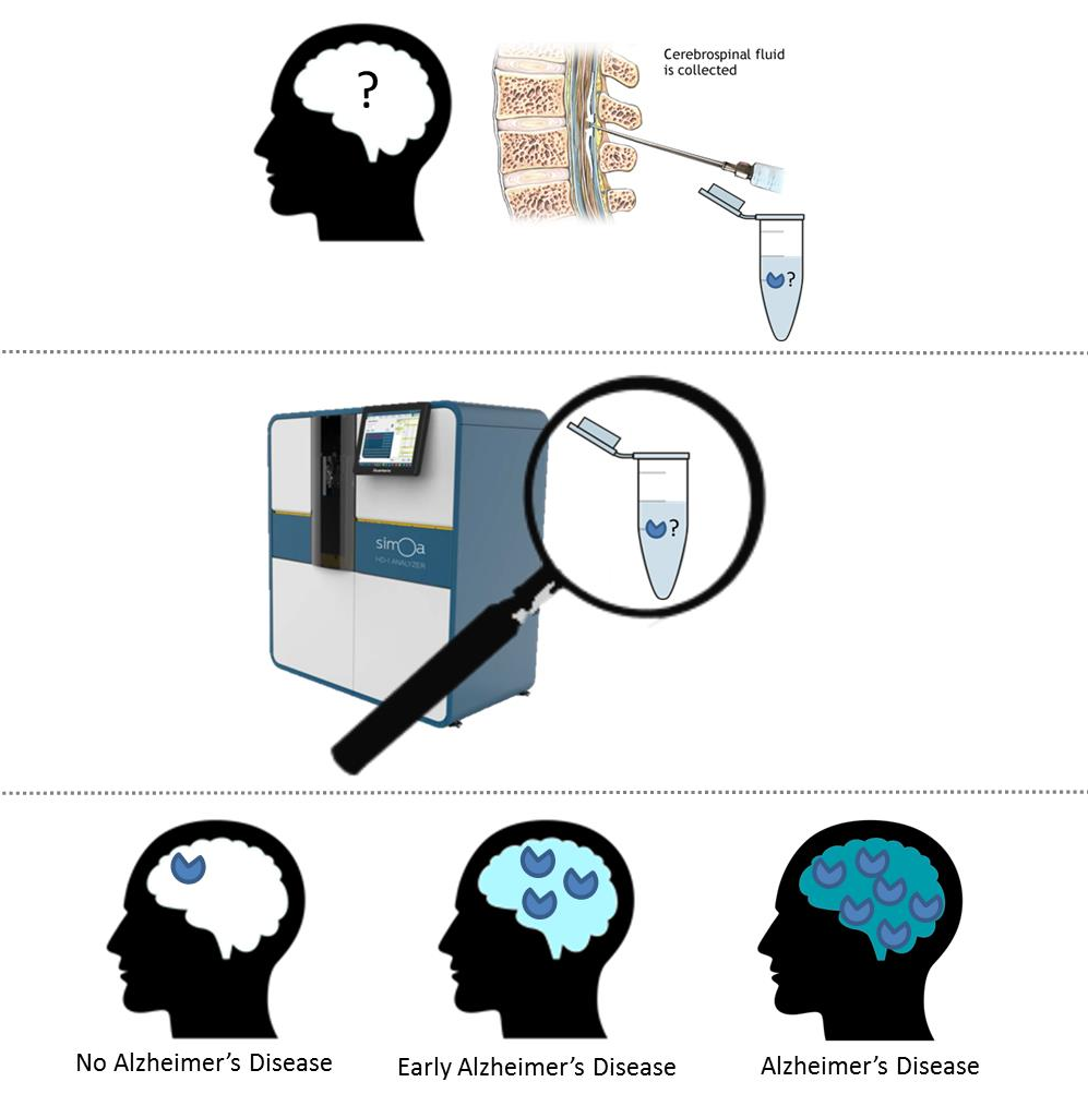 Amyloid beta oligomers in early Alzheimer’s Disease (ABOARD); developing a new diagnostic tool for the most toxic Amyloid beta species using an advanced technological approach