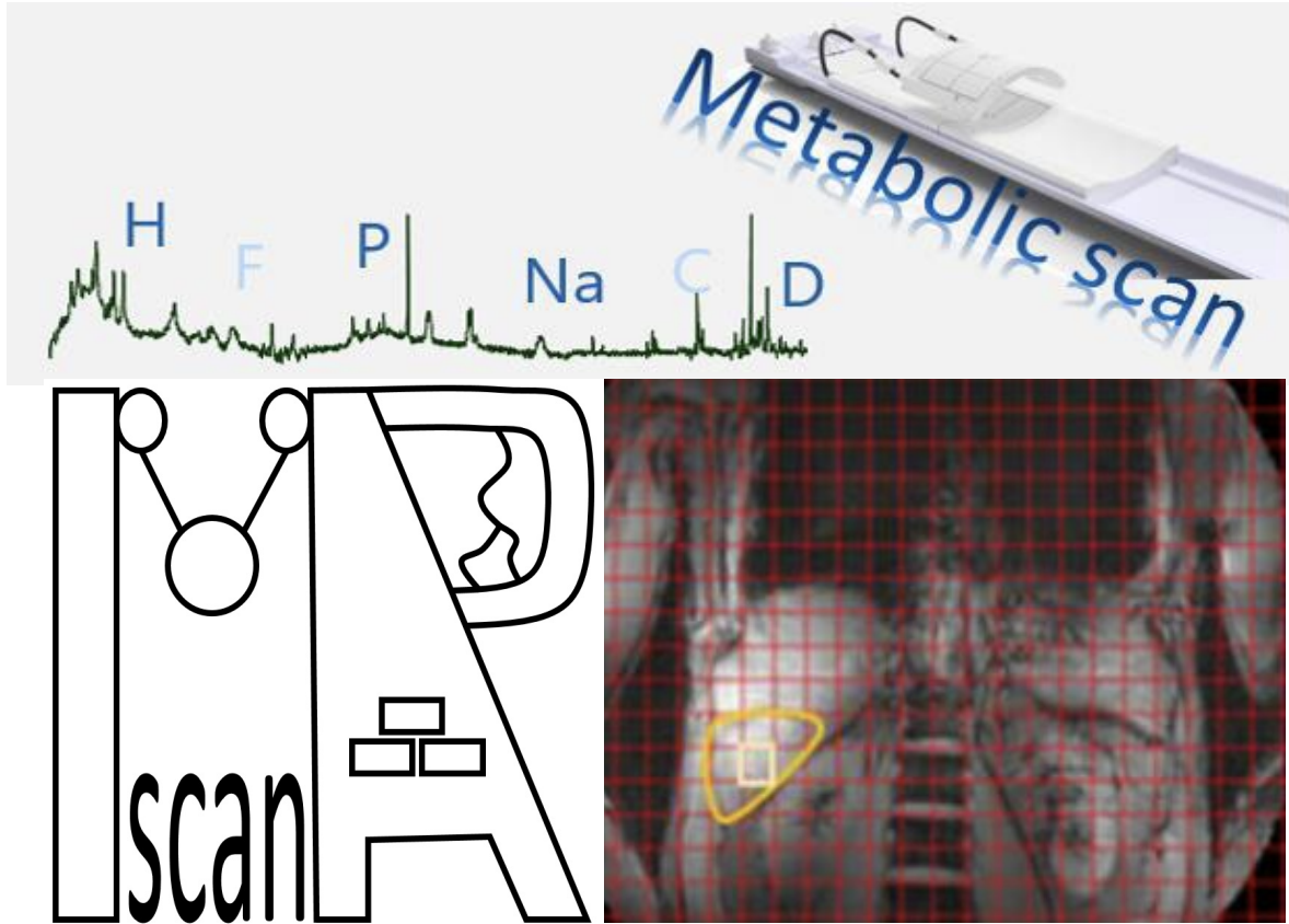 This title (max. 10 words) appears above the project. No use of abbreviations. MAP-scan: Design of Metabolic Anatomic Physiologic MRI for clinic