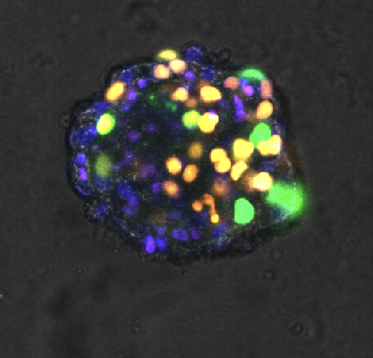 breast cancer microtissue expressing the fucci reporter
