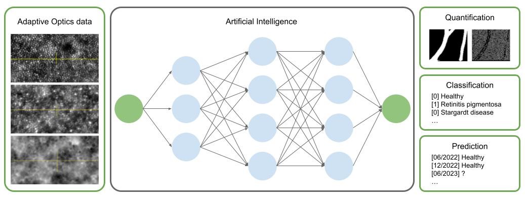 AI