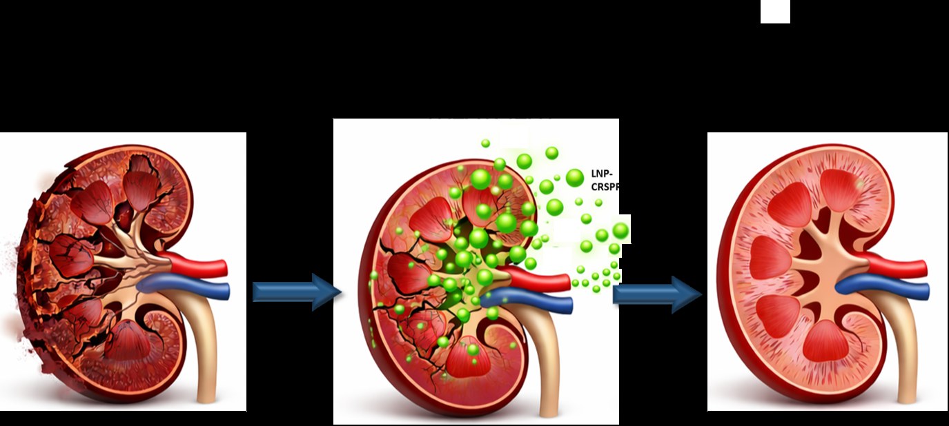 Gene-targeted epigenetic reprogramming to qualify otherwise-discarded kidneys for transplantation
