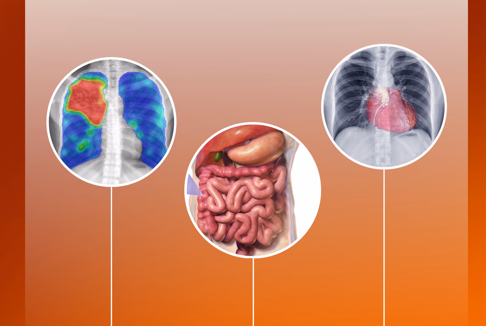 Drie innovaties die dankzij PPS konden doorgroeien