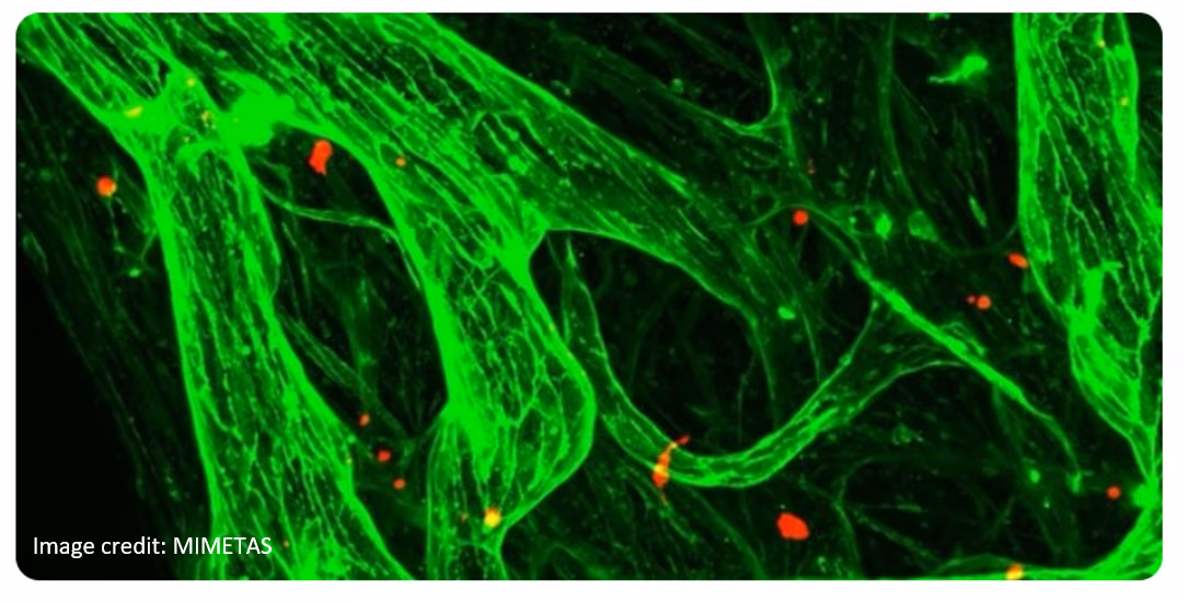 Human Blood Vessels on Chips to Study Viral Disease