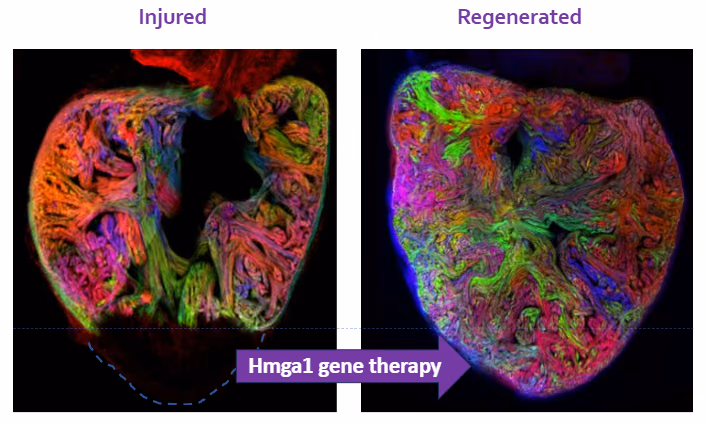Gene Therapy Repairing Hearts after Myocardial Infarction