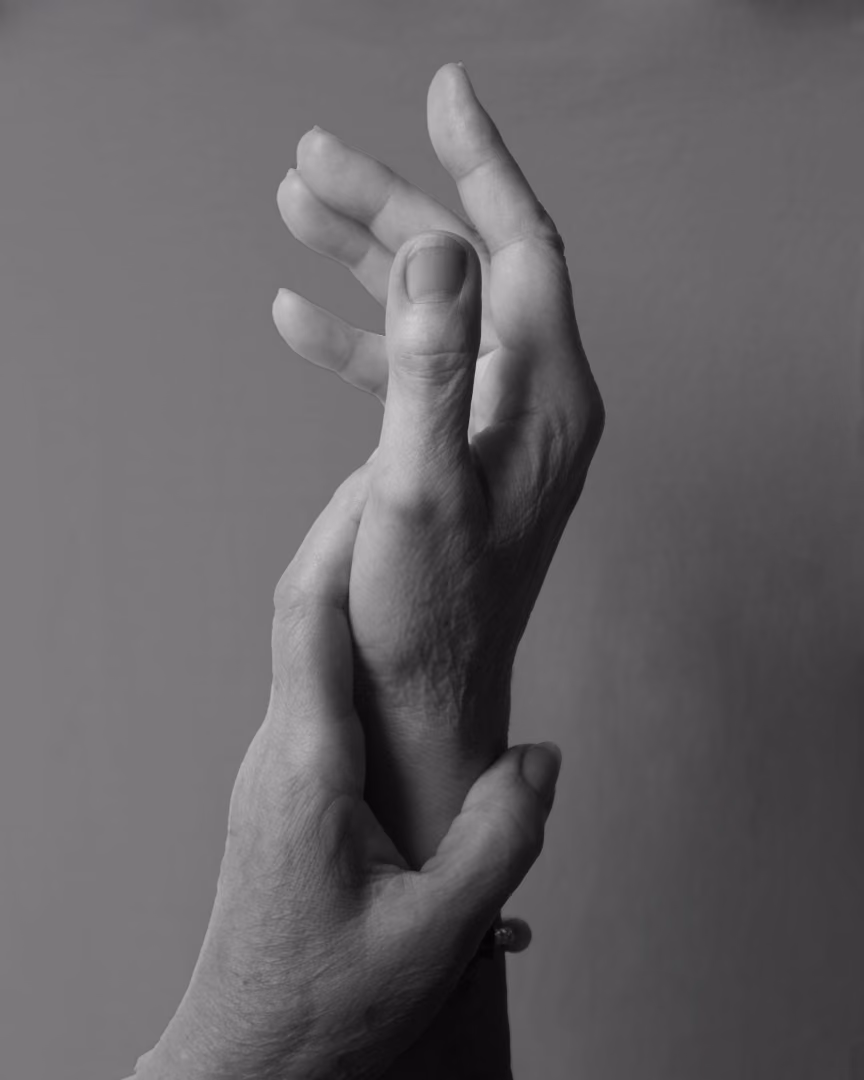 rheumatoid arthritis