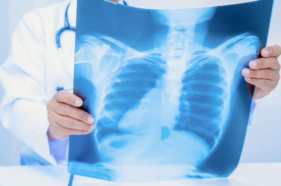 Smart automatic lung scan analysis for better treatment decisions for chronic lung diseases
