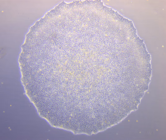 DigitalMLPA: a new technology to monitor genetic stability in stem cells