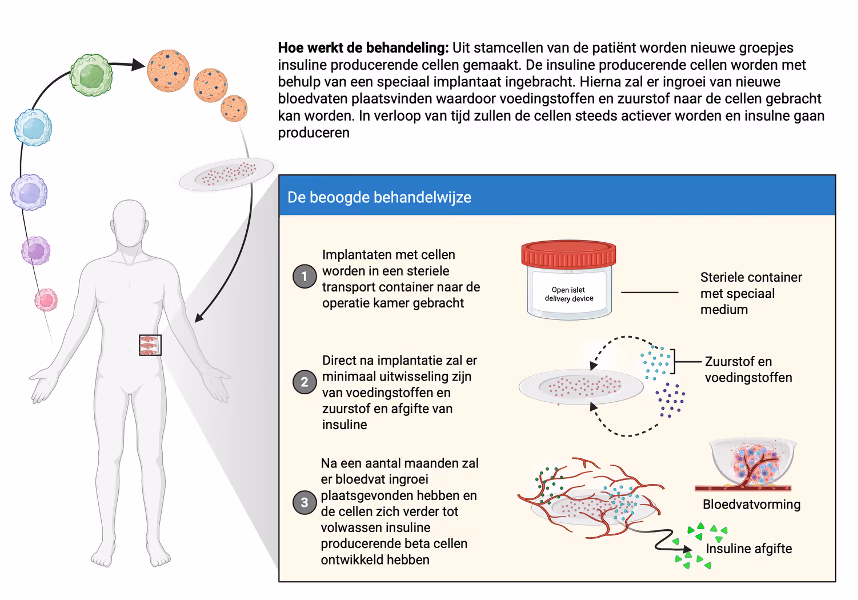INsulin Supply through Personalized Islet Replacement (INSPIRE)