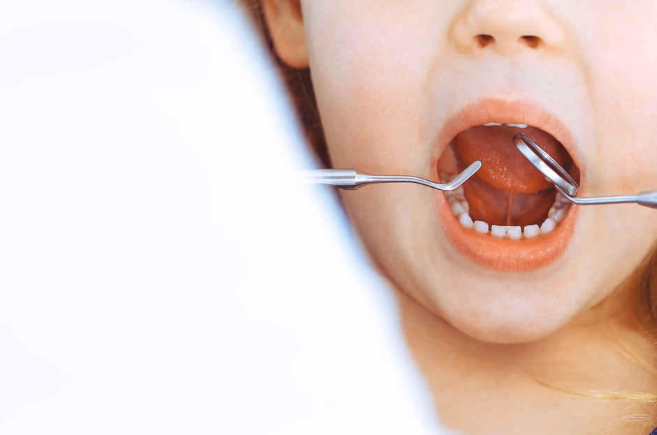 Netwerkkaart Plus: Data-driven Policy Dashboard for Child Oral Health