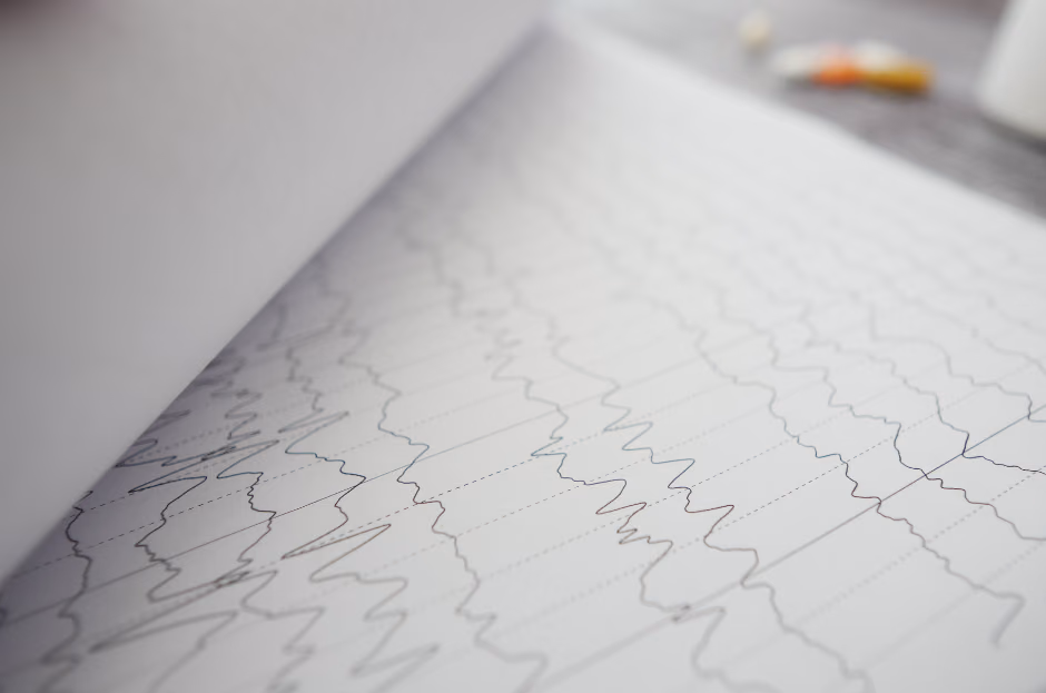 Personalized epilepsy and autism treatments using EEG brain measurements