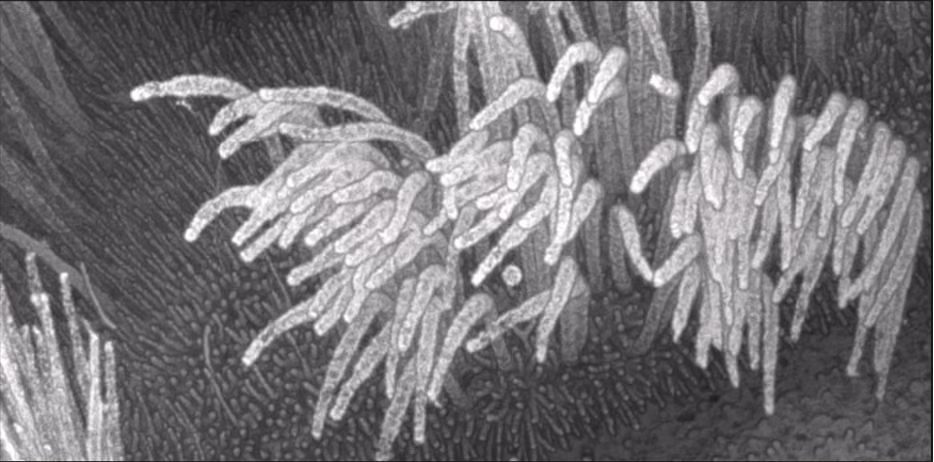 Better tools to diagnose and understand Primary Ciliary Diskinesia