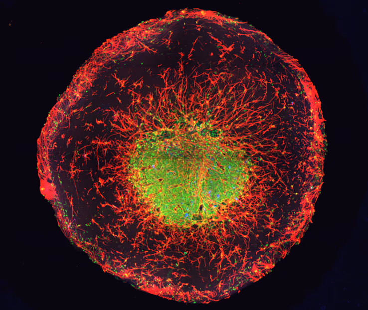 Studying schizophrenia with mini-brains