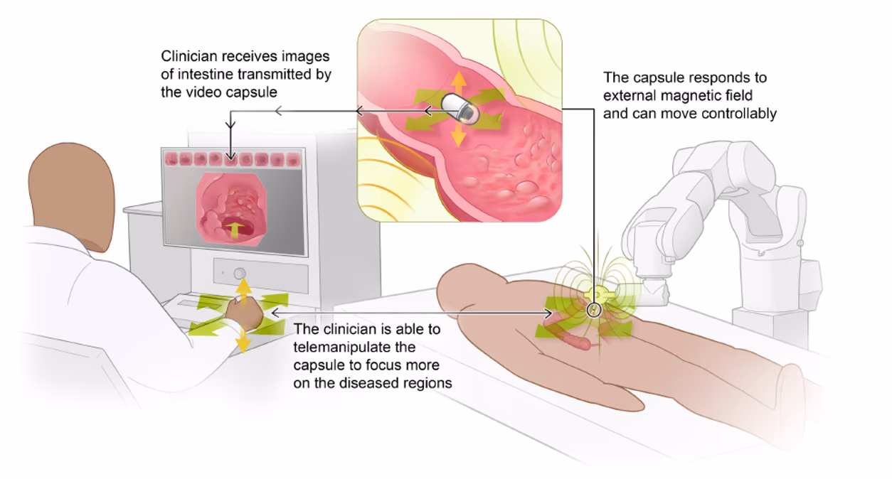 Magnetic Navigation and Artificial Intelligence for Gastrointestinal Diagnostics
