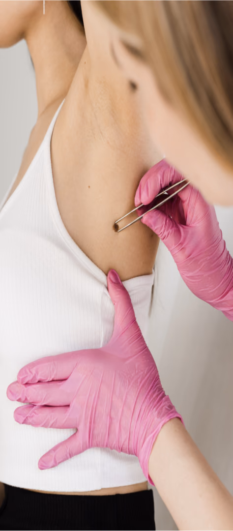 Identifying high-risk melanoma patients through recurrence prediction