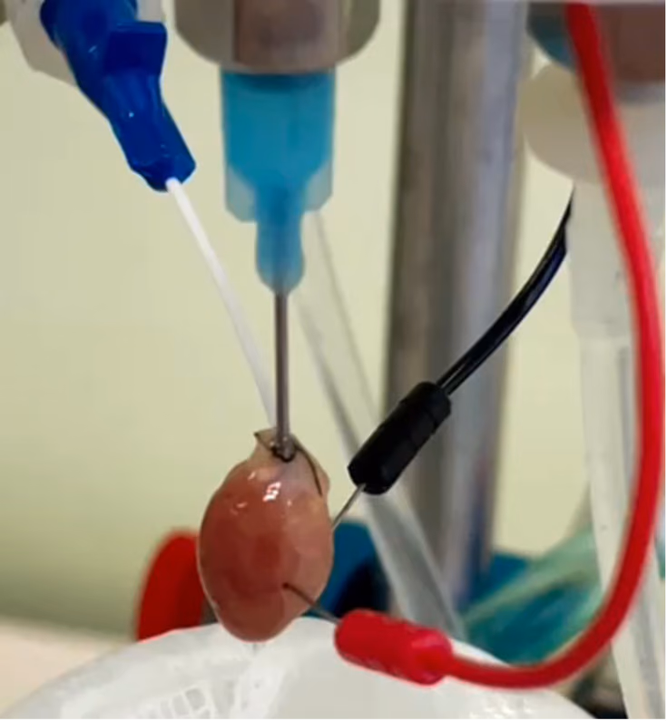 Optimizing donor hearts through machine perfusion