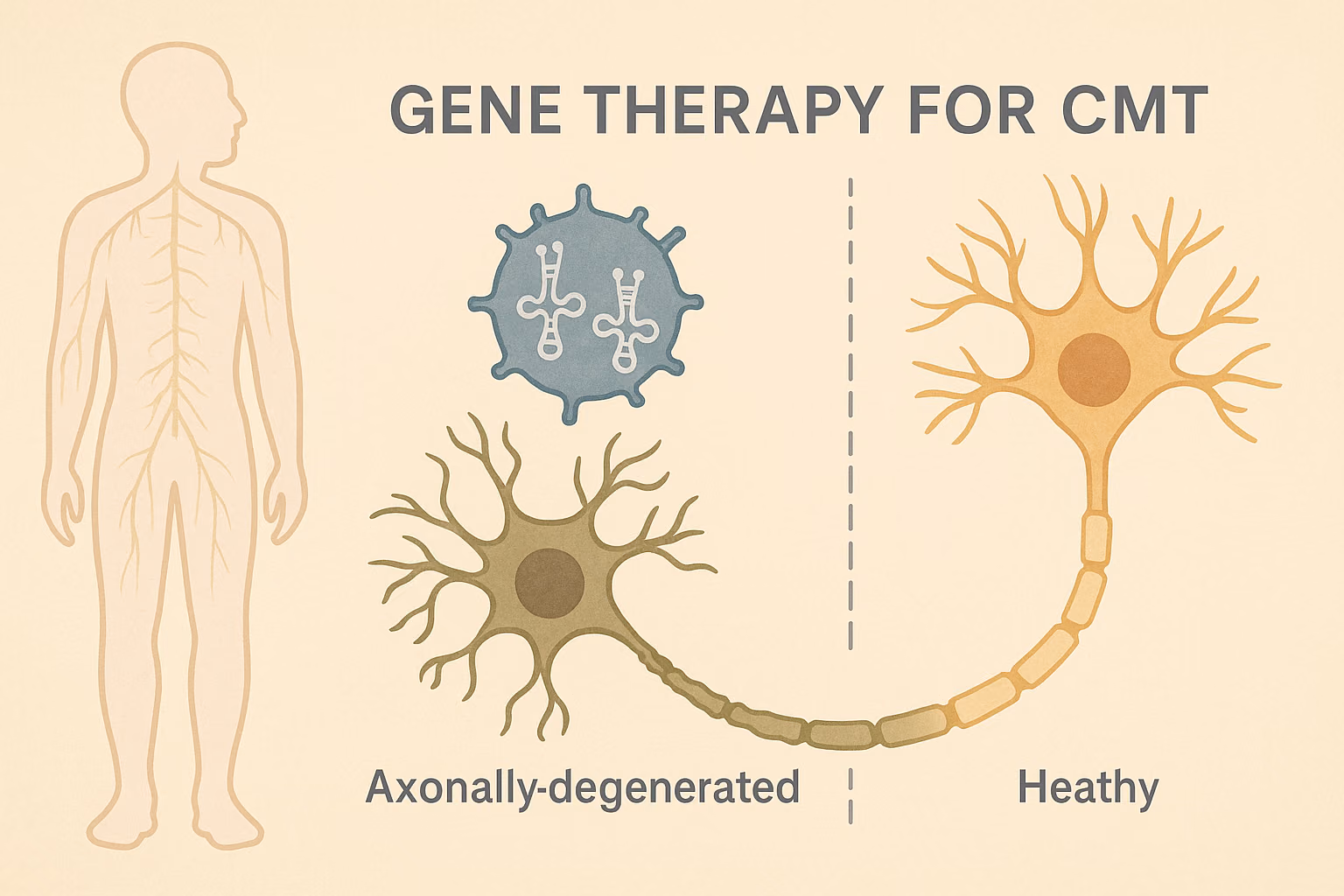 Gene therapy to restore nerve function in rare genetic disease