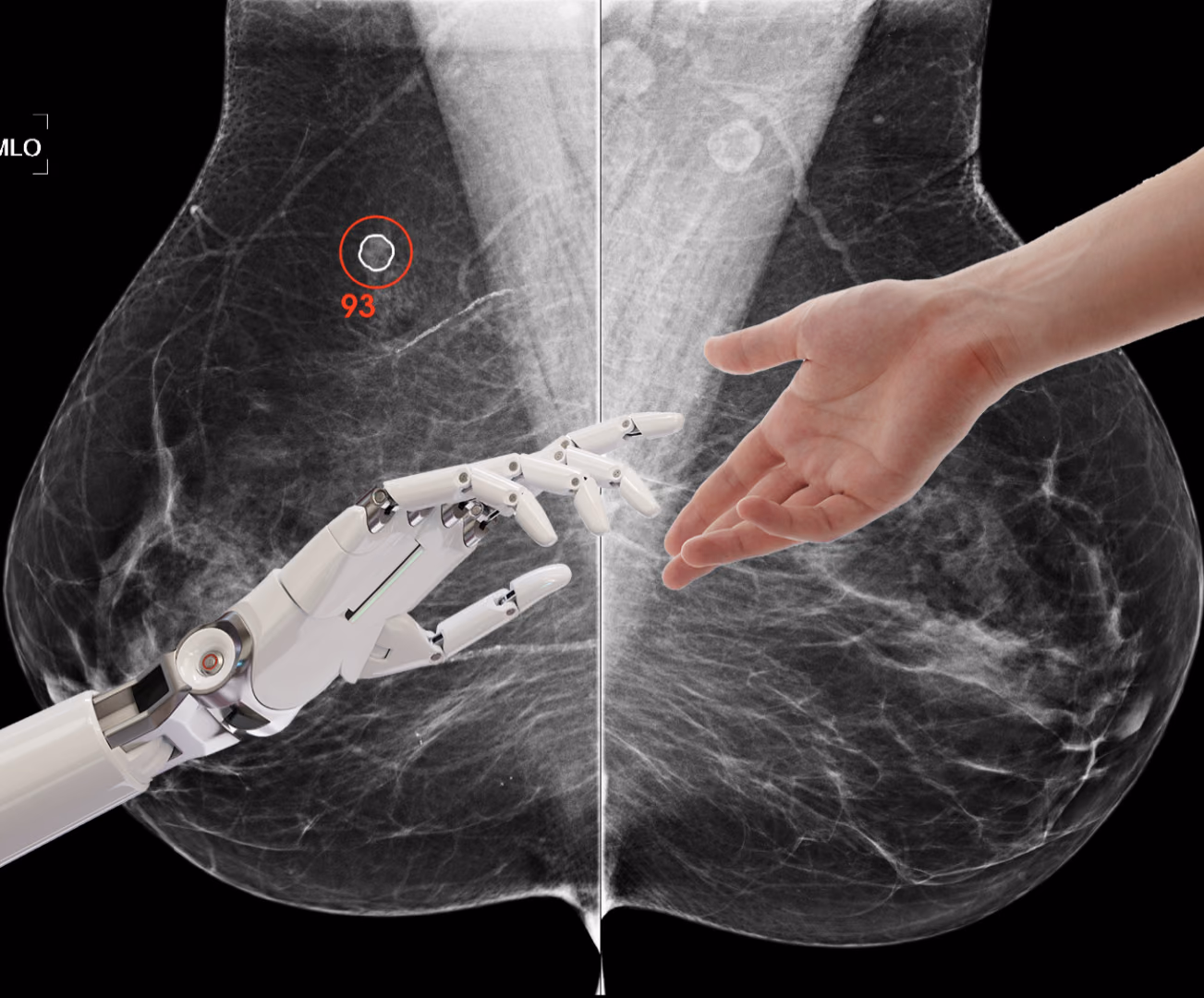 Better breast cancer detection: artificial intelligence and optimal human reading