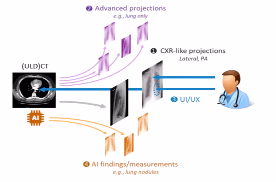 Improving upon conventional chest radiography diagnostics