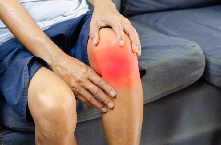 Demonstrating chondroprotective, anti-inflammatory, and analgesic activity of IL4-10FP in osteoarthritis