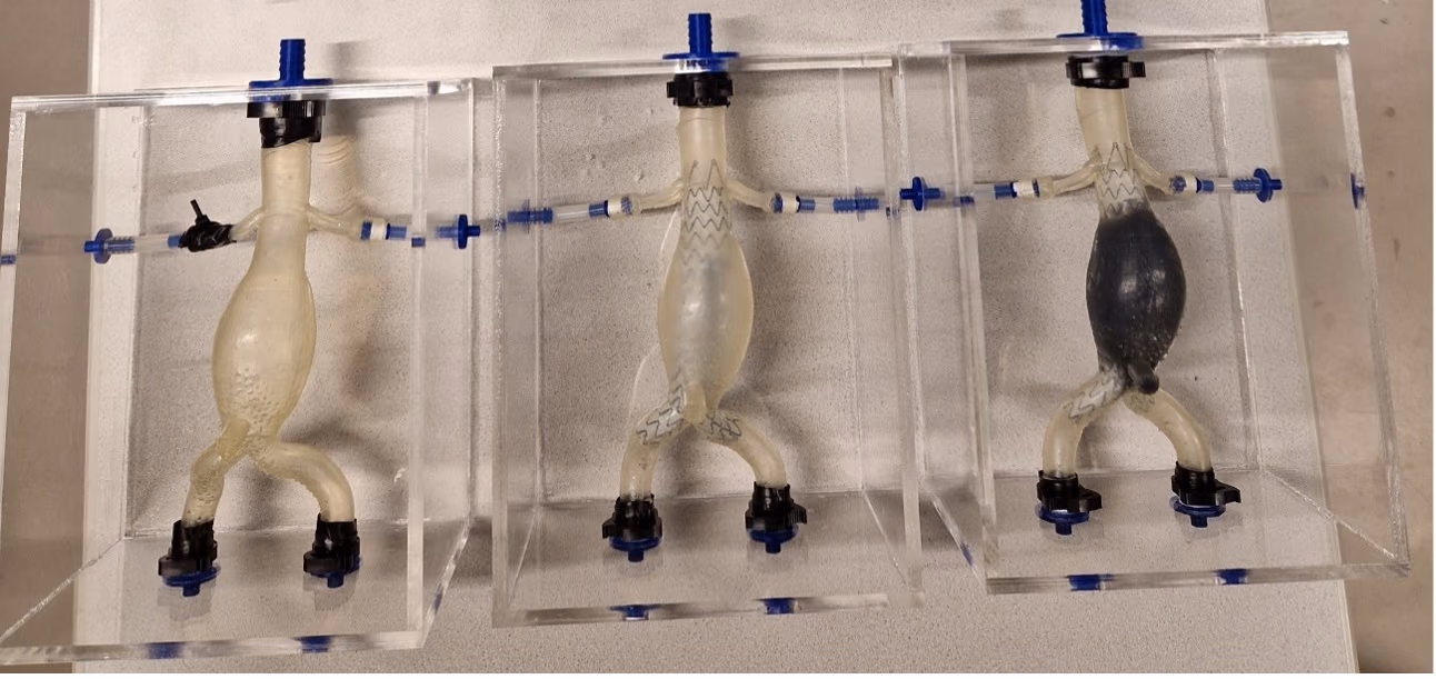 Polymer injection for treatment and prevention of endoleaks