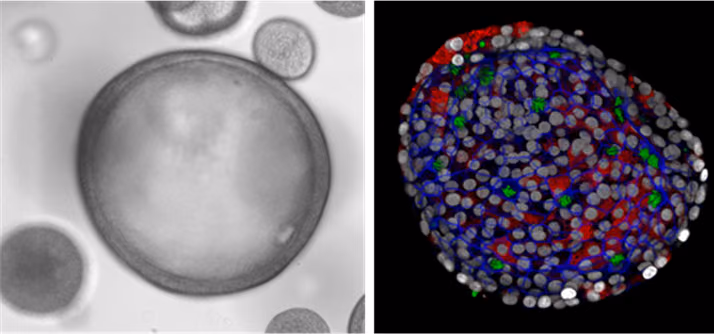 Images of airway organoids grown from nasal cells