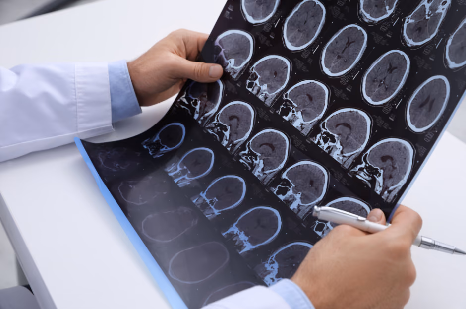 Radiological workflow for diagnostic and treatment decisions in multiple sclerosis