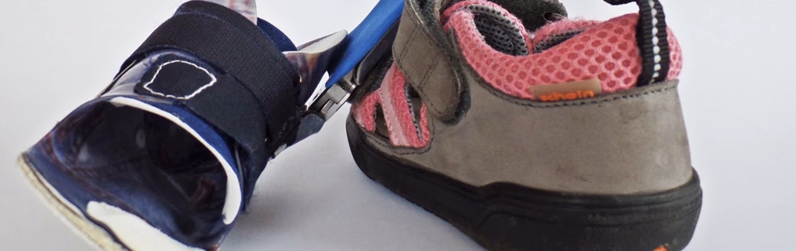 Development of a decision tool to optimize the orthotic design process