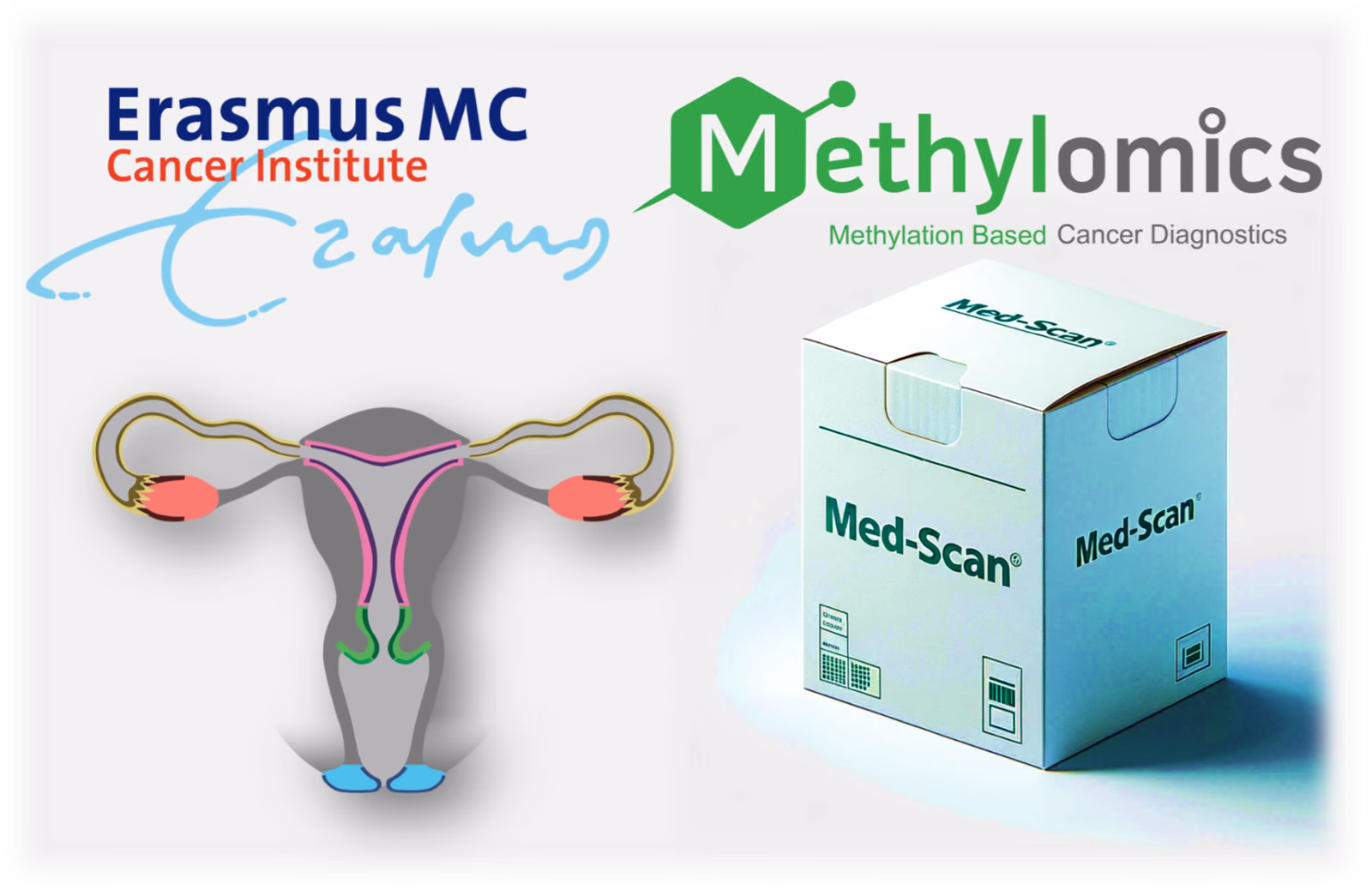 A new woman-friendly self-test to detect endometrial cancer