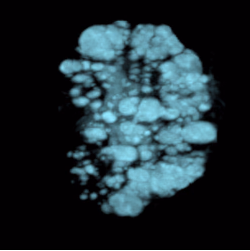 MicroCyst: Modelling Polycystic Kidney Disease