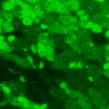 Eccentric exercise in a muscle on a chip model
