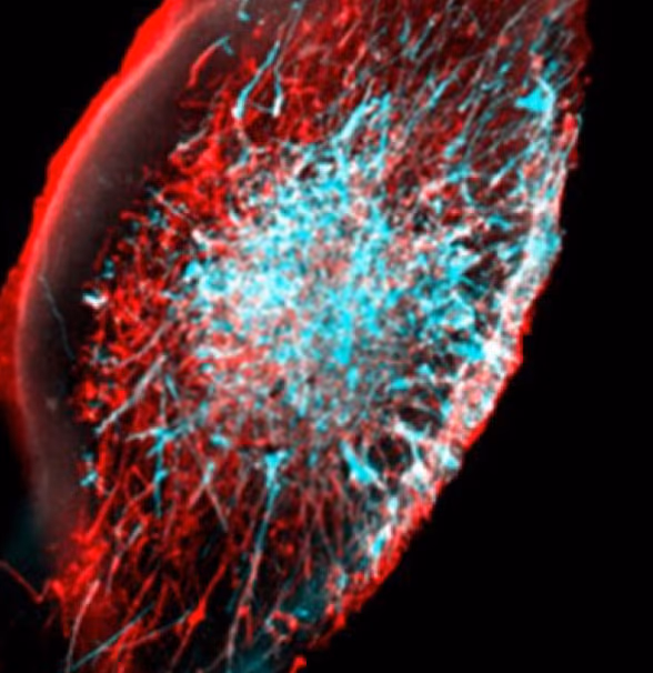 Generation of a brain in vitro model mimicking aging and Parkinson’s disease –PDAGE