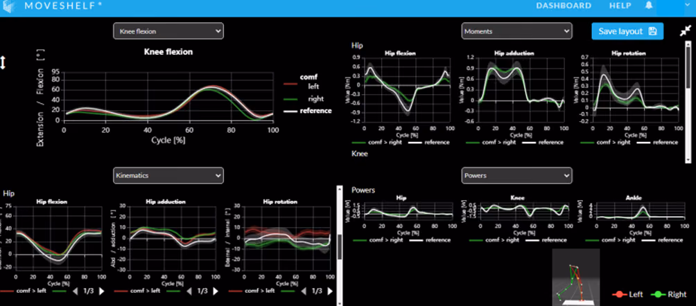 Innovative workflow including Machine-learning Assisted Movement Analysis system and cloud-based infrastructure for children with cerebral palsy