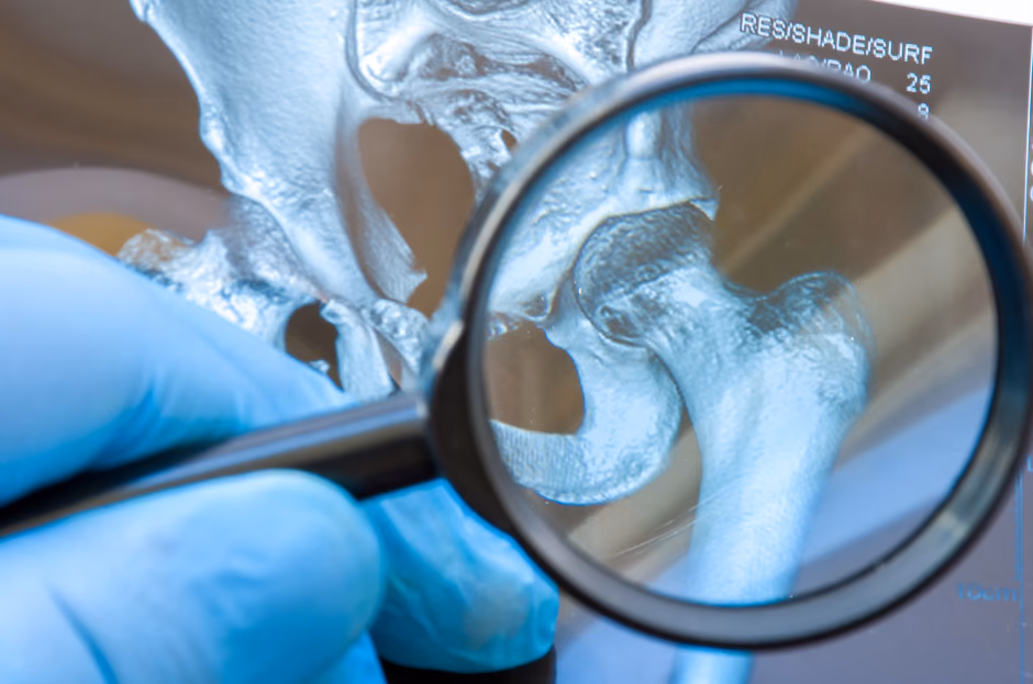 DDH SCREEN US: Ultrasound screening for developmental dysplasia of the hip at the child health care center