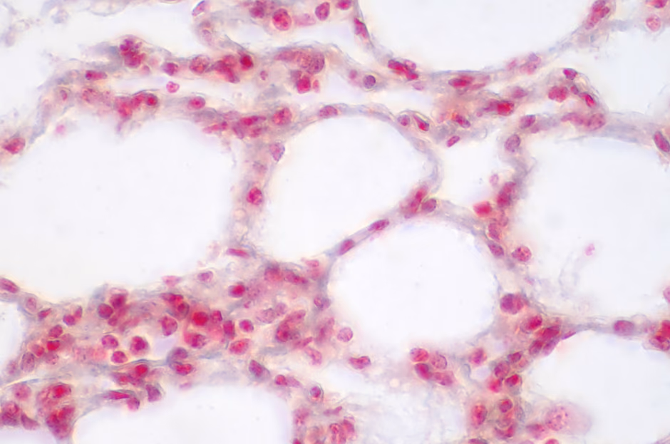 Optical investigation of the tissue response to Negative Pressure Wound Therapy
